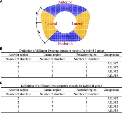 Finite element analysis of optimized novel additively manufactured non-articulating prostheses for cervical total disc replacement
